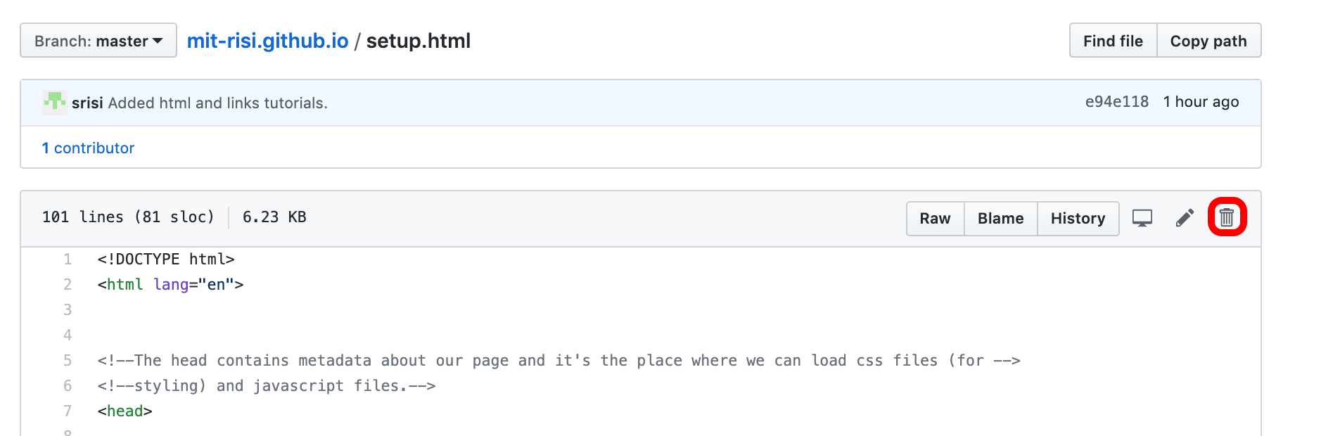 Screenshot of setup.html with highlighted trash button